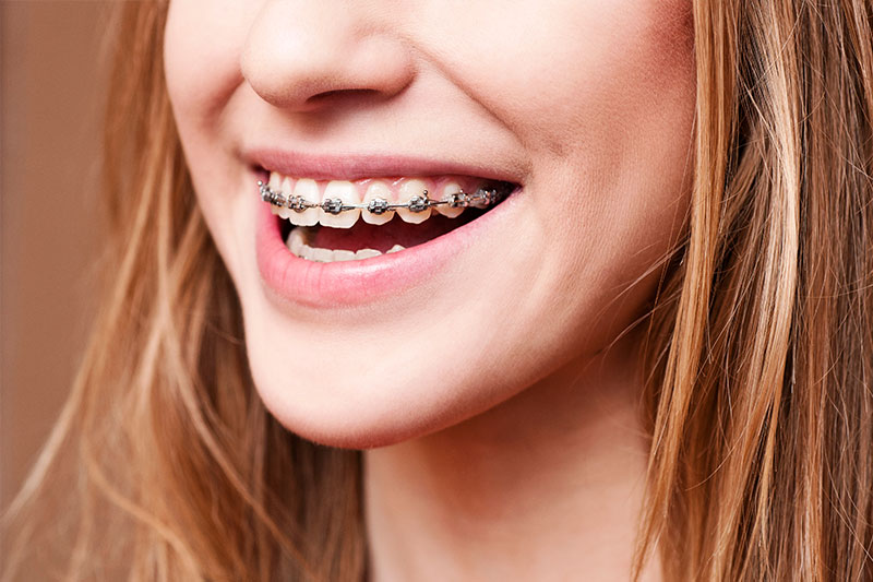 Orthodontics in Inglewood